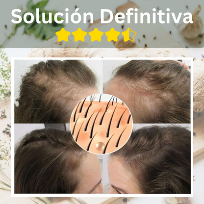 ⚫ COMBO ANTICANAS Jabón Black GRATIS 🟠 + Spray de Crecimiento ⚫  Reviv Hair KIT 2 EN 1 🙋‍♀️🙋‍♂️